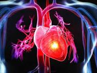 تحقیق پیشگیری از بیماری های قلبی عروقی (عوامل خطر و روش های پیشگیری)